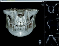 3D-Röntgen/DVT
